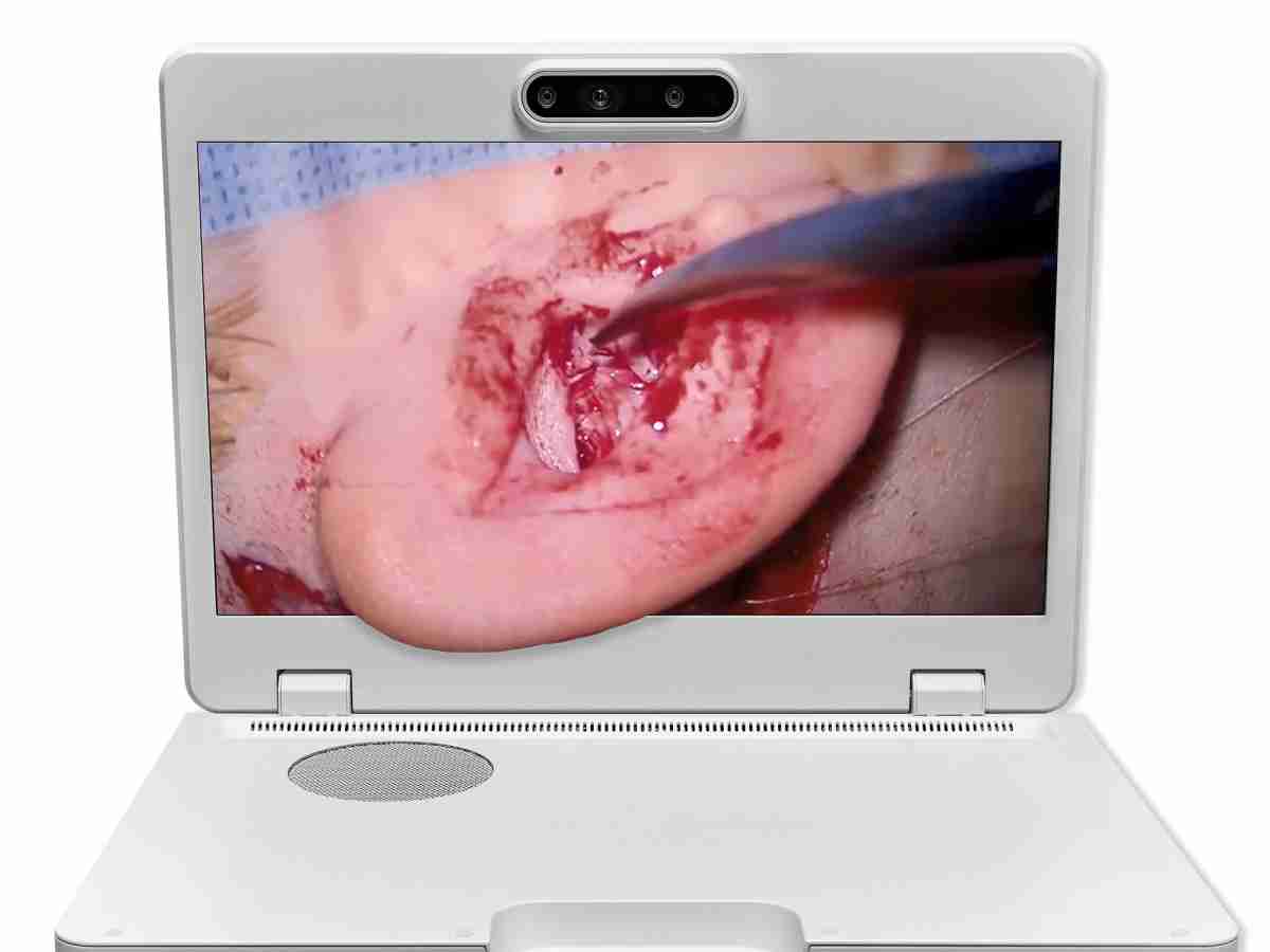 达擎之＂Heads-up 3D显微手术显示系统＂，，整合4K裸眼3D显示及眼球追踪系统，，具备快速追踪人眼移动位置功能，，，，减轻医师长时间维持固定姿势的负担，，让医师能有更宽广清晰的3D立体视野及更舒适的姿势来执行手术。。。